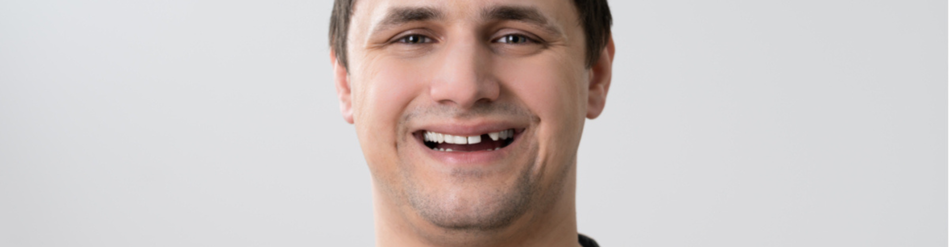 A man smiling with a missing tooth.